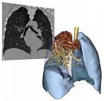 birr-thesis-2011